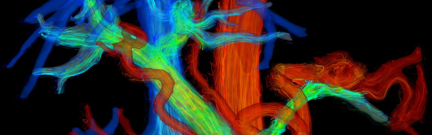 Rendering of flow in the hepatic system